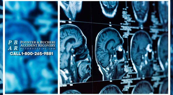 Get Quick Relief from Auto Injury Rehabilitation and Chiropractic Care Services